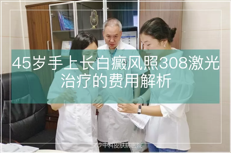 45岁手上长白癜风照308激光治疗的费用解析