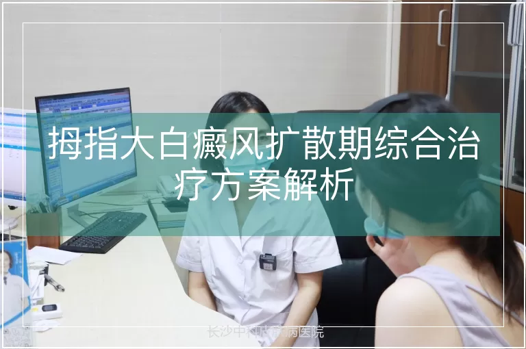拇指大白癜风扩散期综合治疗方案解析