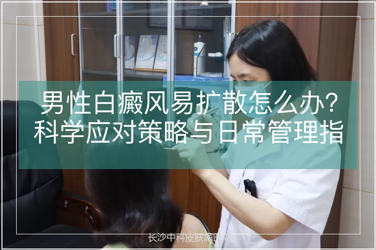 男性白癜风易扩散怎么办？科学应对策略与日常管理指南