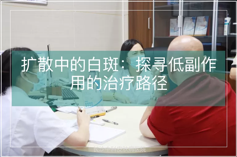 扩散中的白斑：探寻低副作用的治疗路径