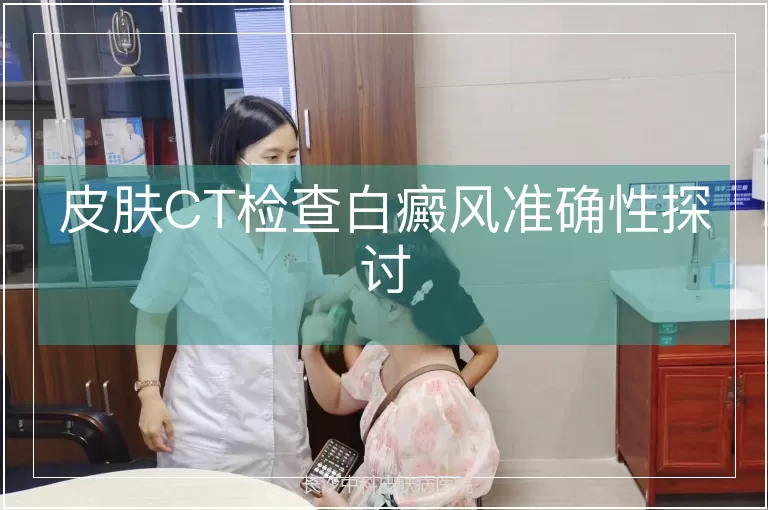 皮肤CT检查白癜风准确性探讨