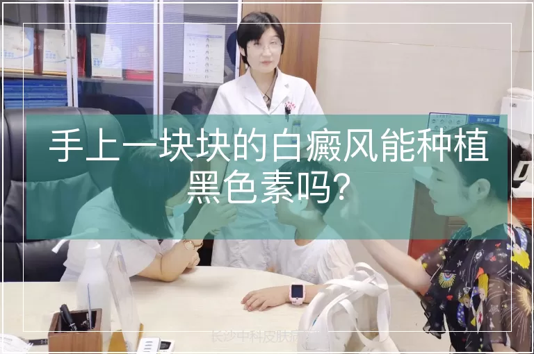 手上一块块的白癜风能种植黑色素吗？