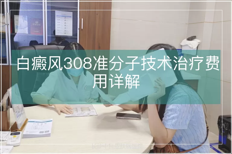 白癜风308准分子技术治疗费用详解