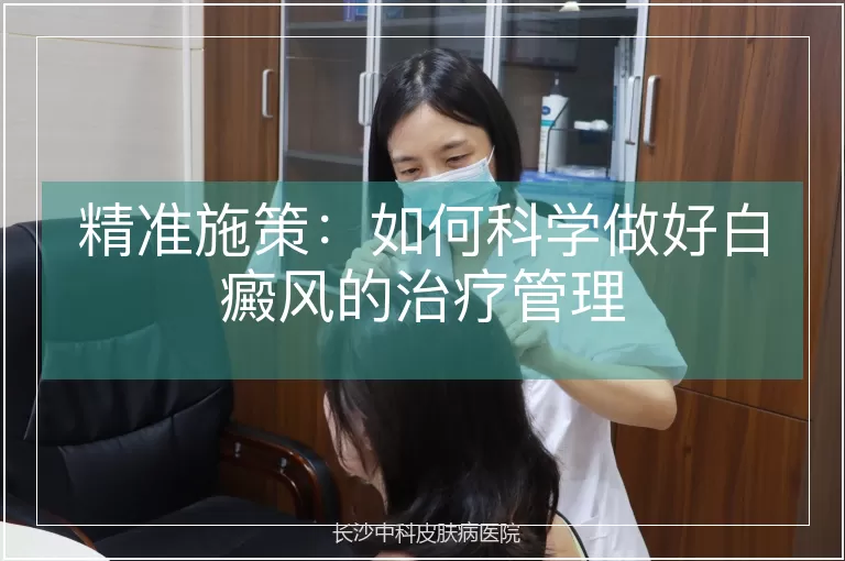 精准施策：如何科学做好白癜风的治疗管理