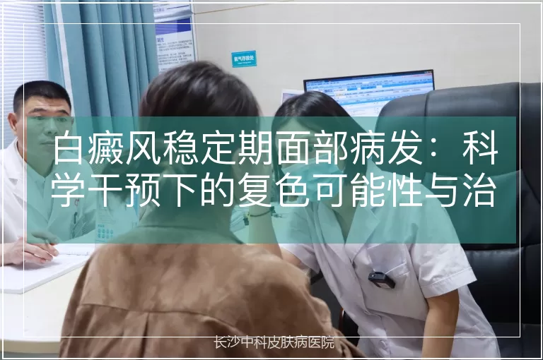 白癜风稳定期面部病发：科学干预下的复色可能性与治疗路径