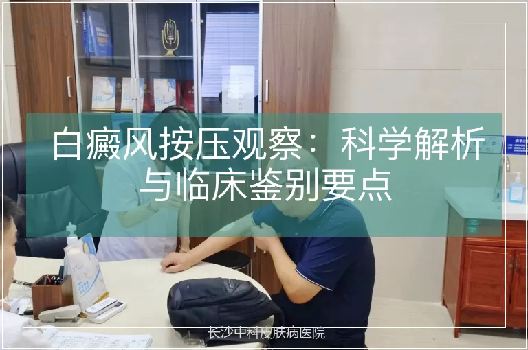 白癜风按压观察：科学解析与临床鉴别要点