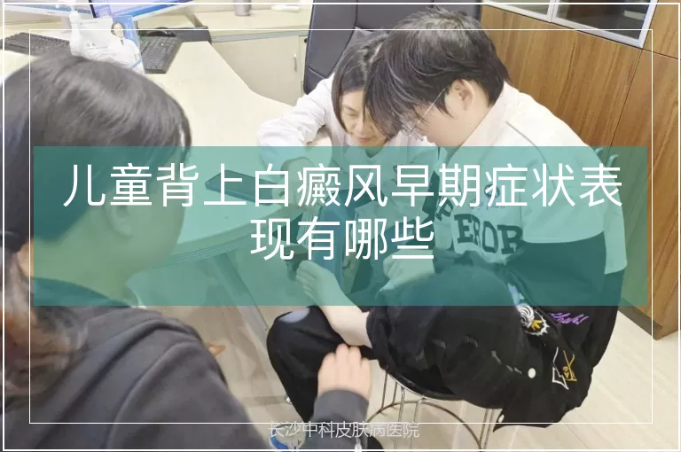 儿童背上白癜风早期症状表现有哪些