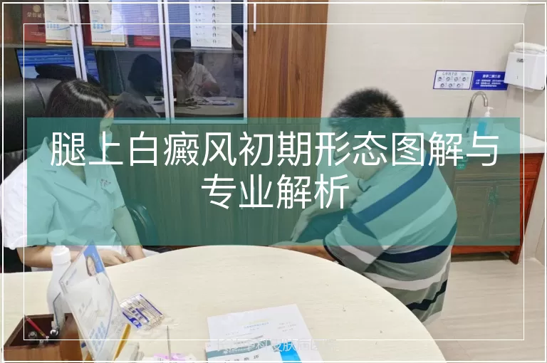腿上白癜风初期形态图解与专业解析