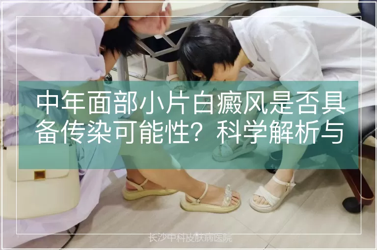 中年面部小片白癜风是否具备传染可能性？科学解析与临床认知