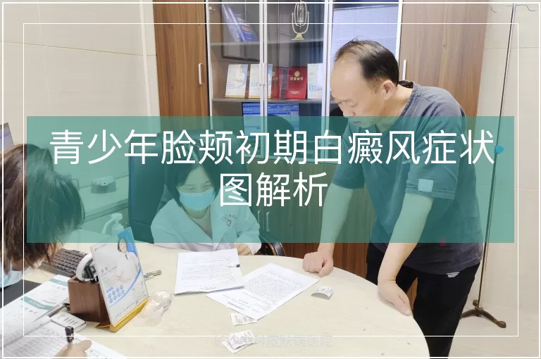 青少年脸颊初期白癜风症状图解析