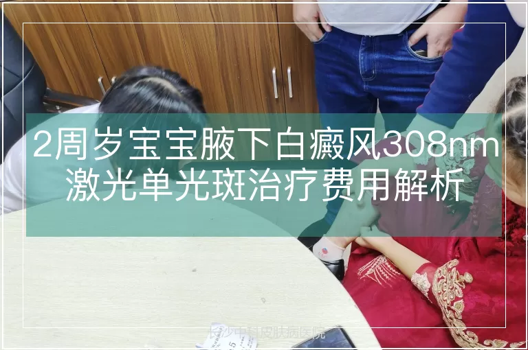 2周岁宝宝腋下白癜风308nm激光单光斑治疗费用解析
