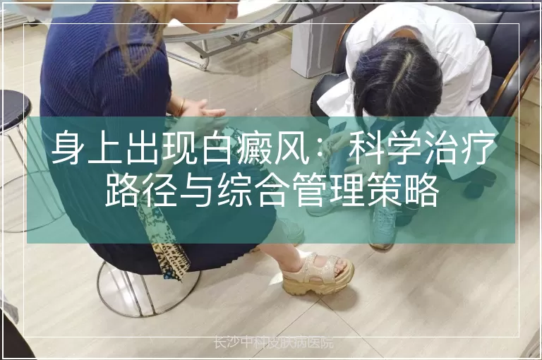 身上出现白癜风：科学治疗路径与综合管理策略