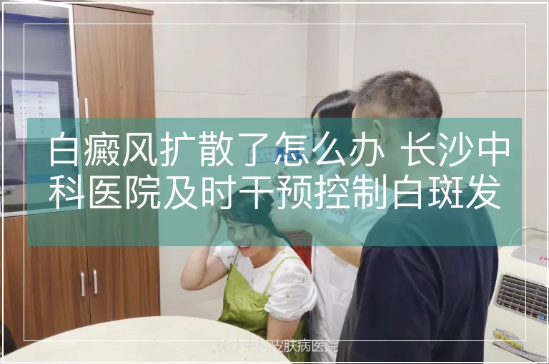 白癜风扩散了怎么办 长沙中科医院及时干预控制白斑发展