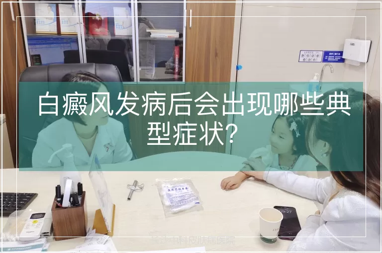 白癜风发病后会出现哪些典型症状？