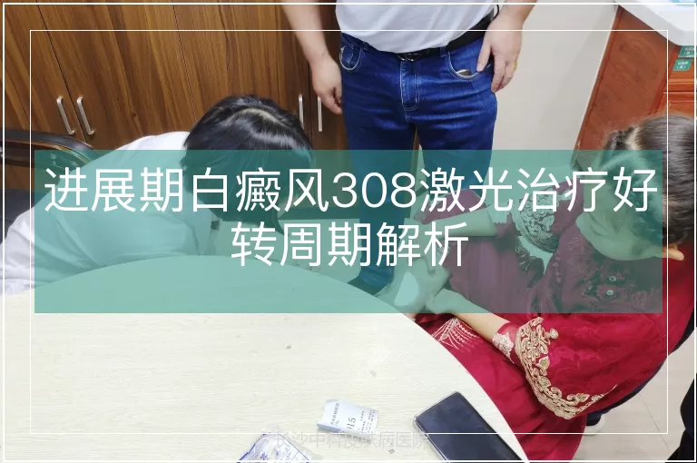 进展期白癜风308激光治疗好转周期解析