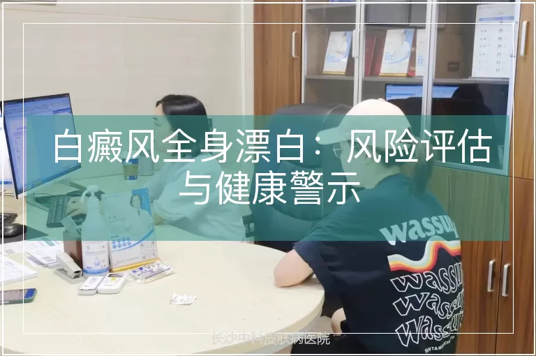 白癜风全身漂白：风险评估与健康警示