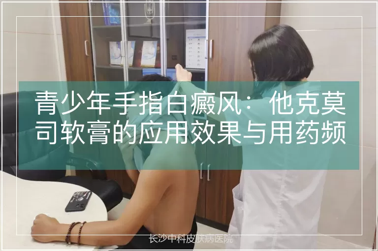 青少年手指白癜风：他克莫司软膏的应用效果与用药频率解析