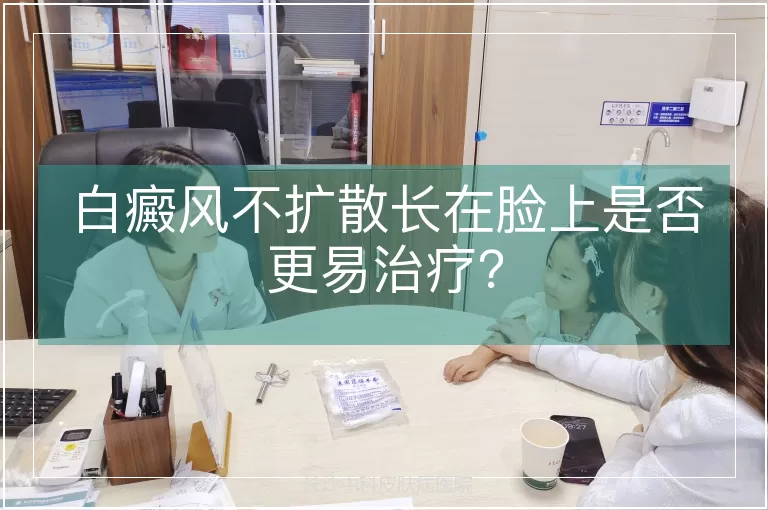 白癜风不扩散长在脸上是否更易治疗？