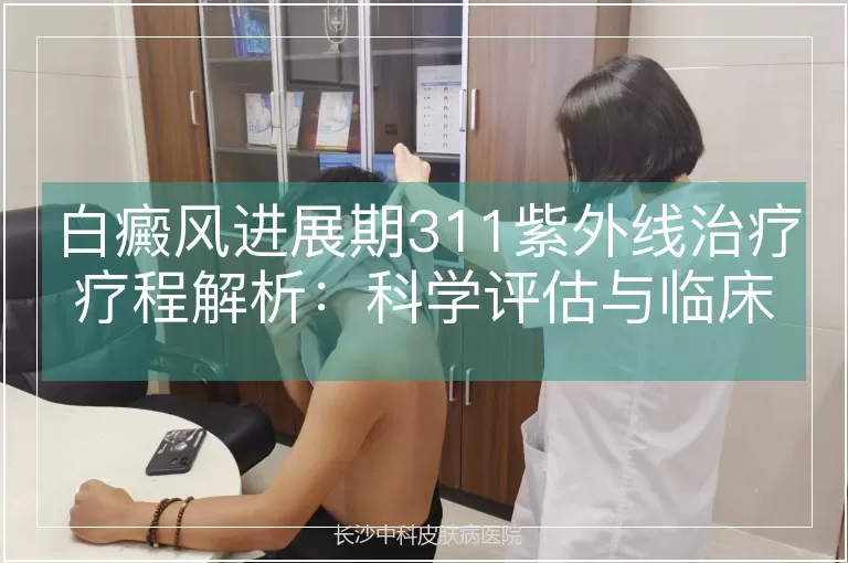 白癜风进展期311紫外线治疗疗程解析：科学评估与临床实践