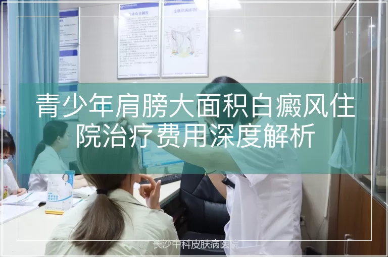 青少年肩膀大面积白癜风住院治疗费用深度解析