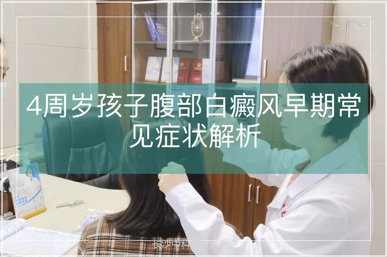 4周岁孩子腹部白癜风早期常见症状解析