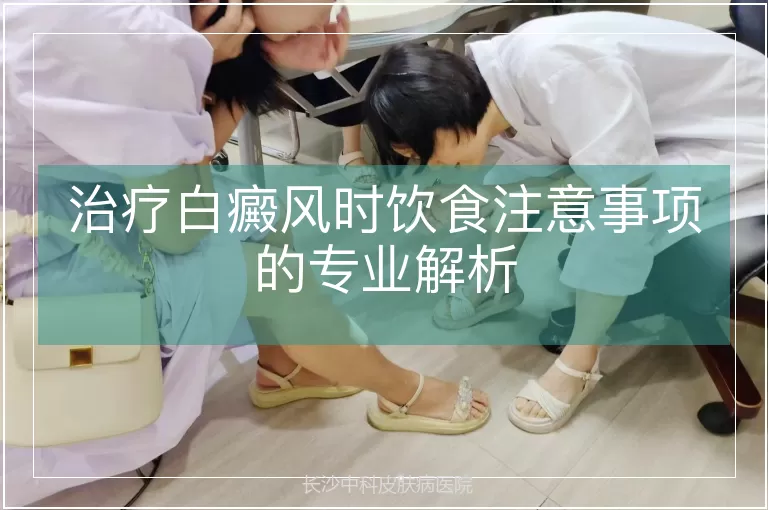 治疗白癜风时饮食注意事项的专业解析