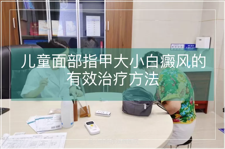 儿童面部指甲大小白癜风的有效治疗方法