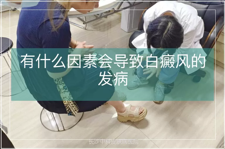 有什么因素会导致白癜风的发病