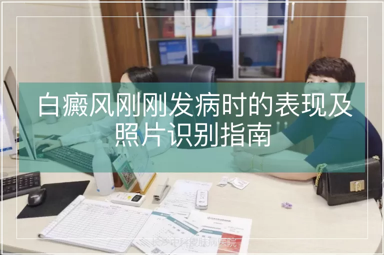 白癜风刚刚发病时的表现及照片识别指南