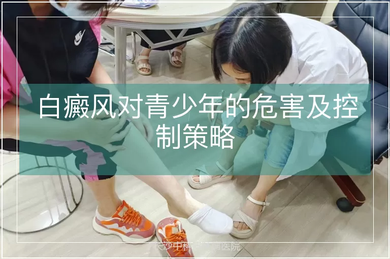 白癜风对青少年的危害及控制策略