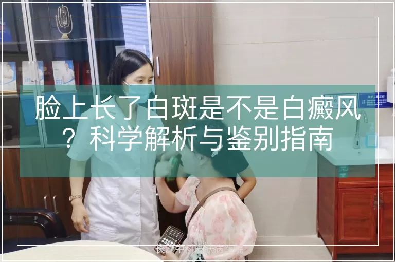 脸上长了白斑是不是白癜风？科学解析与鉴别指南