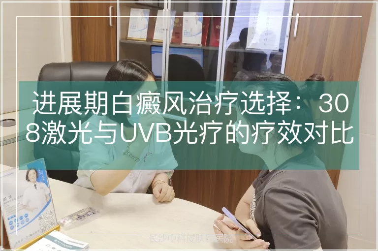 进展期白癜风治疗选择：308激光与UVB光疗的疗效对比分析