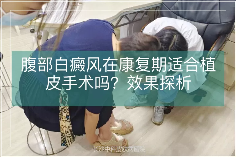 腹部白癜风在康复期适合植皮手术吗？效果探析