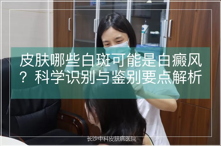 皮肤哪些白斑可能是白癜风？科学识别与鉴别要点解析