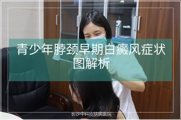 青少年脖颈早期白癜风症状图解析