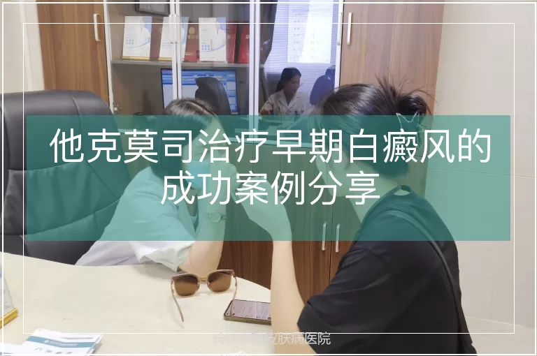 他克莫司治疗早期白癜风的成功案例分享
