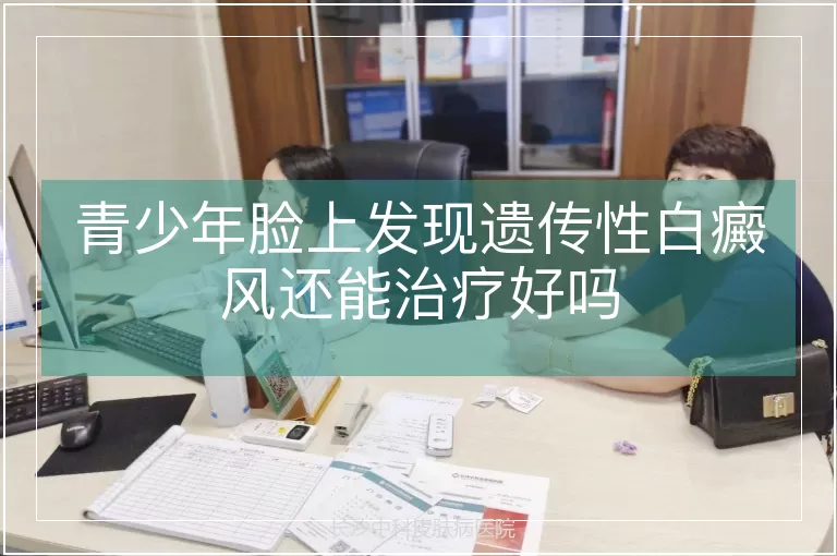 青少年脸上发现遗传性白癜风还能治疗好吗