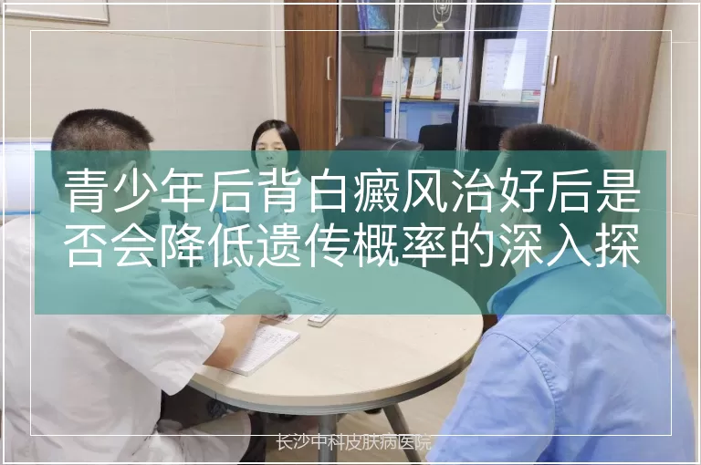 青少年后背白癜风治好后是否会降低遗传概率的深入探讨
