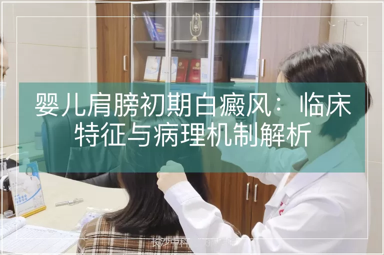 婴儿肩膀初期白癜风：临床特征与病理机制解析