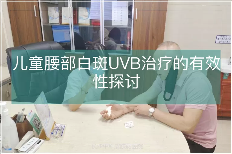 儿童腰部白斑UVB治疗的有效性探讨