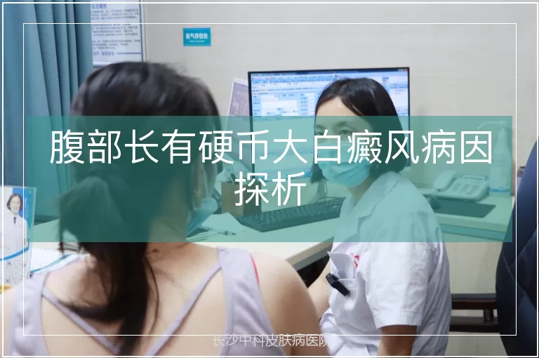 腹部长有硬币大白癜风病因探析