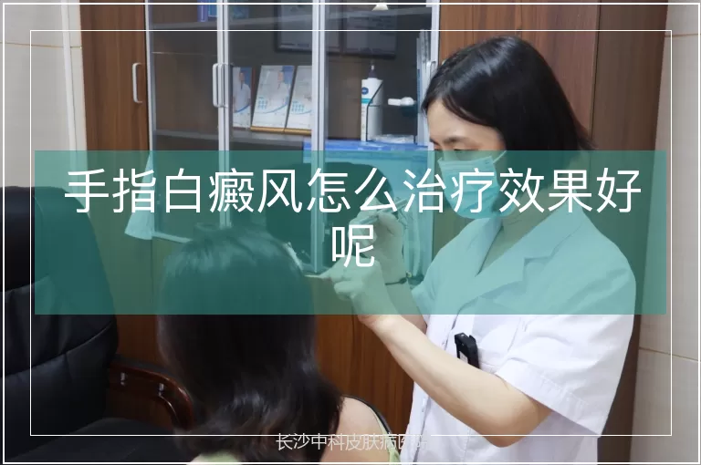 手指白癜风怎么治疗效果好呢