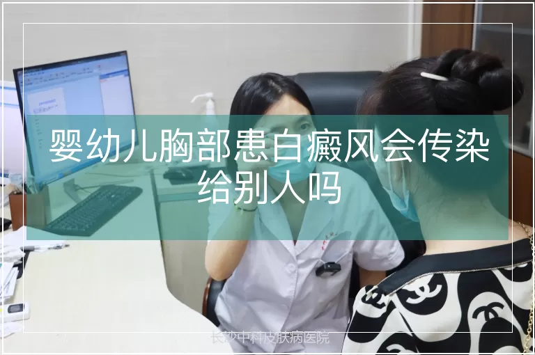 婴幼儿胸部患白癜风会传染给别人吗