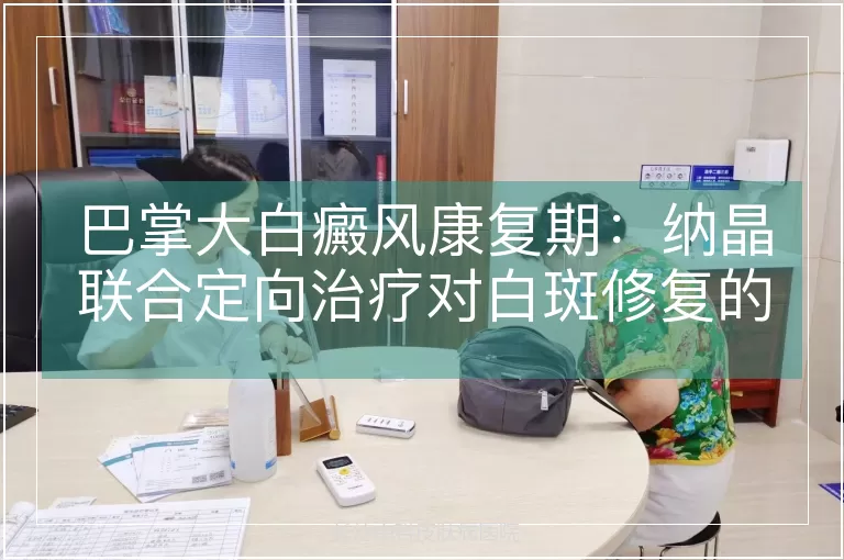 巴掌大白癜风康复期：纳晶联合定向治疗对白斑修复的效能评估