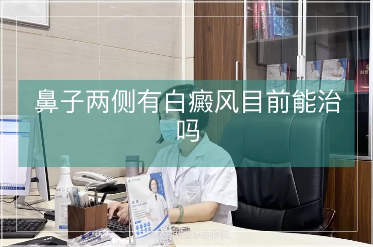 鼻子两侧有白癜风目前能治吗