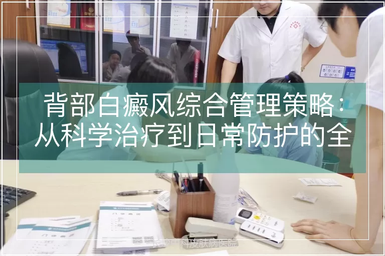背部白癜风综合管理策略：从科学治疗到日常防护的全路径解析