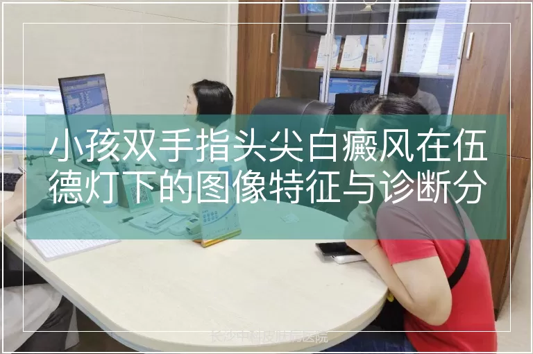 小孩双手指头尖白癜风在伍德灯下的图像特征与诊断分析