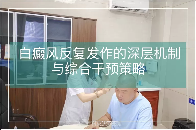 白癜风反复发作的深层机制与综合干预策略