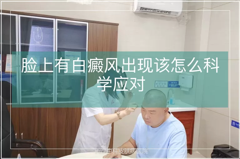 脸上有白癜风出现该怎么科学应对