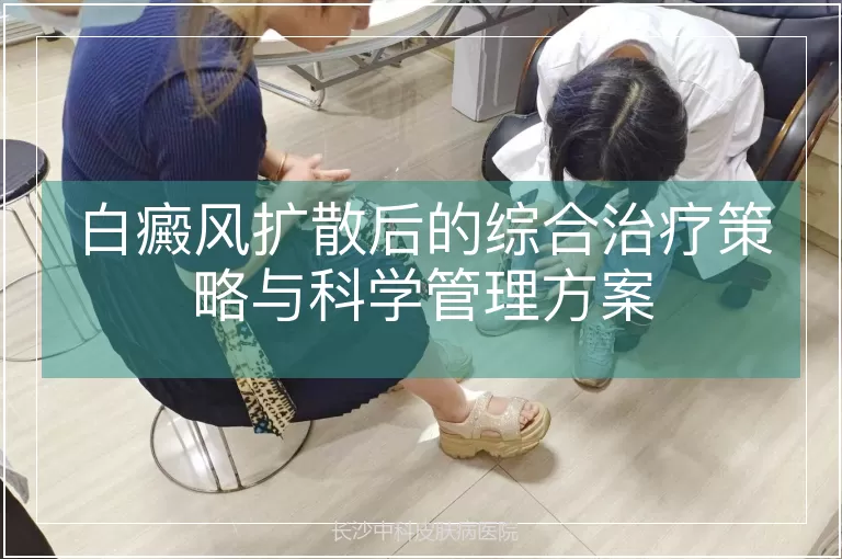 白癜风扩散后的综合治疗策略与科学管理方案